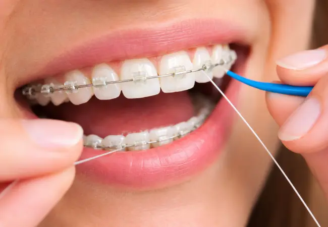 how to floss with braces