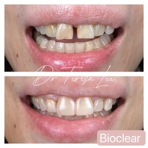 smile-gallery-photo2