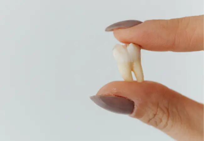 do's and don'ts after tooth extraction