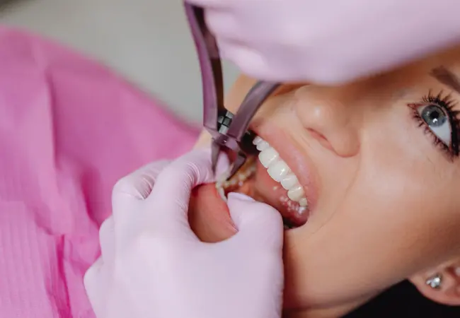 tooth extraction