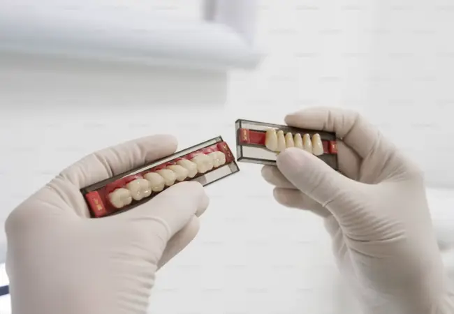 dental crowns in vancouver
