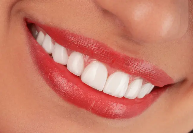 professional teeth whitening in vancouver