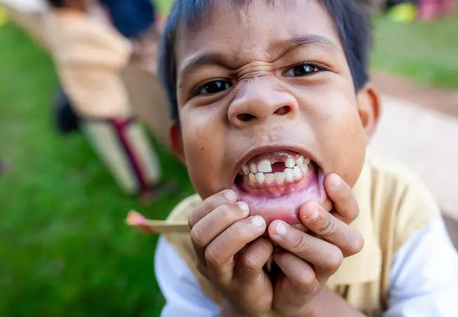 knocked-out tooth