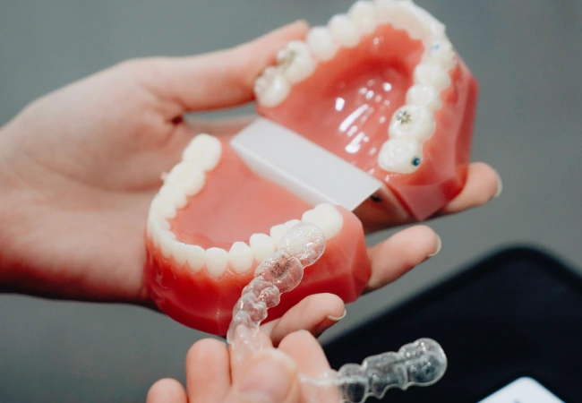 retainer after invisalign